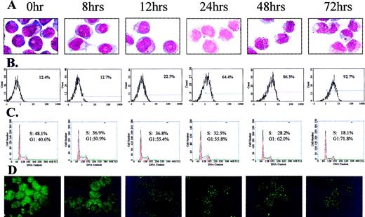 Fig. 3. Differentiation status, cell cycle distribution, and PML-staining patterns of NB4 cells at distinct time-points of an ATRA treatment. / Differentiation of the cells was evaluated by (A) morphological changes (Wright's staining) and (B) CD11b expression. (C) The percentages of G1/G2- and S-phase cells at the same time-points were measured by PI staining and FACS analysis. (D) PML/RAR, PML localization in corresponding time-points was studied using immunofluorescence methods with antihuman PML antibodies.