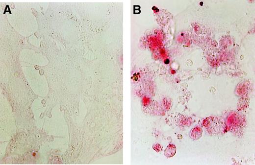 Fig. 4. Rapidly proliferating HUVECs were grown to 70% confluence on poly-D-lysine–coated coverslips and incubated in culture medium with and without As2O3 for 24 hours. / (A) Control cells. (B) The photographs (original magnification 500 ×) show strongly increased TUNEL staining after treatment with 5 × 10−6 mol/L As2O3 in comparison with control cells.