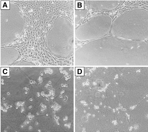 Fig. 8. Effect of As2O3 on Matrigel-induced tube formation of HUVECs in vitro. / HUVECs (1 × 105 cells/well) were plated on growth-factor–reduced Matrigel in the presence of a culture medium. (A) Culture medium contained X-Vivo and endothelial cell growth supplement (ECGS). (B) Culture medium contained X-Vivo, ECGS, and VEGF (20 ng/mL). (C) Culture medium contained X-Vivo, ECGS, VEGF (20 ng/mL), and 5 × 10−7 mol/L As2O3. (D) Culture medium contained X-Vivo, ECGS, VEGF (20 ng/mL), and 5 × 10−6 mol/L As2O3.