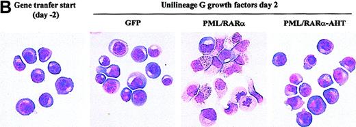 Fig. 2. PML/RARα induces promyelocytic differentiation of HPC. / (A) The morphology of the cells was analyzed on cytospin slides stained with May-Grünwald-Giemsa. (first left panel) HPCs stimulated with IL-3, FLT3 ligand, and stem cell factor (see “Materials and methods”) before retroviral infection. (right panels) HPCs transduced with the control (GFP) or the indicated fusion protein vector. Mature G cells comprise metamyelocytes, myelocytes, and granulocytes. Mean ± SD values from 5 experiments. The percentage of CD34+cells in the different samples is analyzed by FACS and is indicated above the columns. Single and double asterisks above the columns indicate statistical significance (P < .0001) of the differences in GFP vs. PML/RARα cells and PML/RARα vs. PML/RARα-AHT cells, respectively, as calculated from Student 2-tailed t test. (B) Representative cytospins of the samples described in A.
