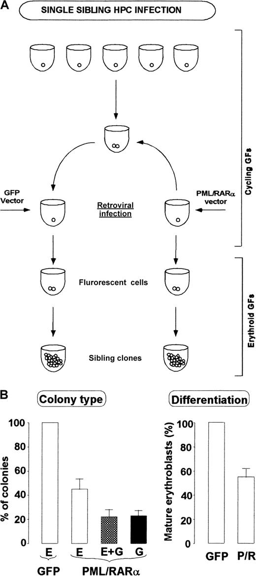 Fig. 5. HPC commitment reprogramming by PML/RARα: single-cell analysis. / (A) Scheme of sibling HPCs generation, infection and analysis. (B) Morphologic analysis of the clones generated by single sibling HPC infected with control (GFP) or PML/RARα vector. (left panel) E, erythroid clones; E + G mixed clones with erythroid and myeloid cells, mostly represented by promyelocytes; G, granulocytic clones, primarily promyelocytic. (right panel) Differentiation levels of erythroid clones, as evaluated from percentages of orthochromatic erythroblasts. Mean ± SD values from 3 experiments in which at least 20 sibling colonies/vector were studied.