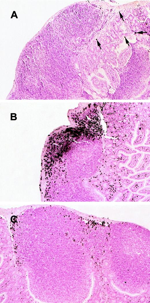 Fig. 1. Histologic analysis of eosinophils in Peyer's patches of wild-type and IL-5–transgenic mice. / Eosinophils were evaluated in the Peyer's patches of wild-type (A), IL-5–transgenic (B), and IL-5–transgenic eotaxin-deficient (C) mice. Eosinophils were identified by anti-MBP immunostaining. In (A), eosinophils are indicated with arrowheads. The original magnification is × 106.