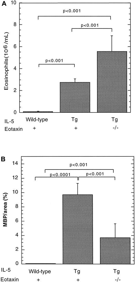 Fig. 2. The effect of the IL-5 transgene on eosinophils in wild-type or eotaxin-deficient mice. / Eosinophils were quantitated in the blood (A) and Peyer's patches (B) of wild-type, IL-5–transgenic (Tg), and eotaxin-deficient (−/−) IL-5–transgenic mice. The level of eosinophils in Peyer's patches was determined by immunohistochemical staining with anti-MBP, followed by morphometric analysis and represented as mean ± SEM (n = 8-11). Statistical significance of experimental groups was analyzed using the unpaired Student t test. Normalization of Peyer's patch eosinophils per mm2 resulted in 0.62 ± 0.39 and 90 ± 25 (mean ± SEM, n = 8-14) eosinophils/mm2for wild-type and IL-5–transgenic mice, respectively.