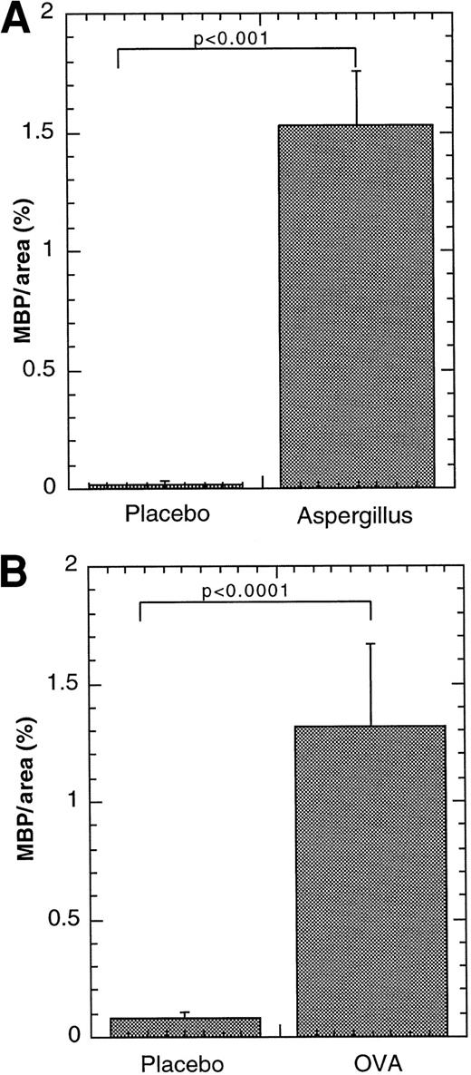 Fig. 4. Effect of allergen challenge on eosinophil levels in Peyer's patches. / Eosinophils were quantitated in the Peyer's patches of wild-type mice subjected to intranasal (A) or oral (B) allergen or placebo challenge. Eosinophils in the Peyer's patches were determined by anti-MBP immunostaining and the results are expressed as MBP per Peyer's patches area (%), based on morphometric analysis. The results are represented as mean ± SEM (n = 9-12). Statistical significance of experimental groups was analyzed using the unpaired Studentt test. Normalization of Peyer's patch eosinophils per mm2 resulted in 0.32 ± 0.21 and 16.1 ± 4.6 (mean ± SEM, n = 6) eosinophils/mm2 for saline andA fumigatus antigen–challenged mice, respectively; and 0.76 ± 0.42 and 15.0 ± 8.7 (mean ± SEM, n = 7-10) for placebo- and OVA-challenged mice, respectively.