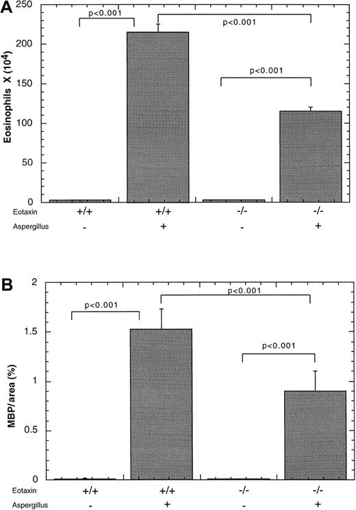 Fig. 5. Effect of intranasal allergen challenge on eosinophil levels in eotaxin-deficient mice. / Mice were subjected to the induction of allergic airway inflammation by repeated challenges with A fumigatus antigen (+) or saline (−) and the level of eosinophils was measured 18 hours after the last challenge. The level of eosinophils was quantitated in the (A) bronchoalveolar lavage fluid (BALF) and (B) Peyer's patches of wild-type (+/+) or eotaxin-deficient (−/−) mice. The results are expressed as mean ± SEM (n = 7).