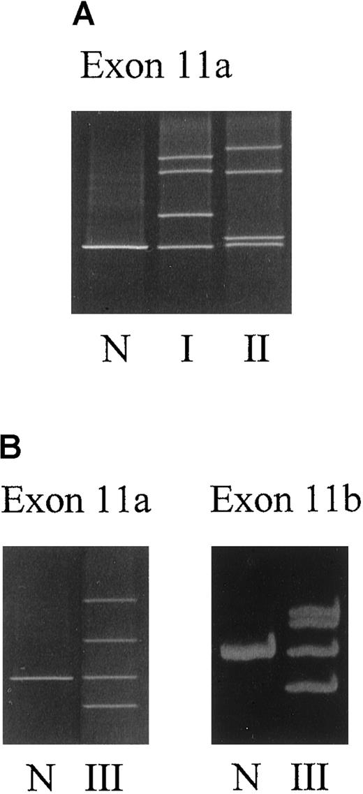 Fig. 1. DGGE analysis of exon 11a and exon 11b of the FECHgene. / (A) Family I (I) and patient II (II). (B) Family III (III). N indicates normal sample. Sample preparation is as described in “Materials and methods.”