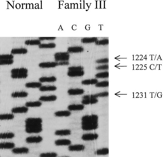 Fig. 2. Nucleotide sequence of FECH cDNA derived from direct sequencing of PCR products of index patient of family III. / Note triple mutation: T →A at nucleotide 1224, C →T at nucleotide 1225, and T →G at nucleotide 1231. These 3 mutations lead to a FECH variant with N408K, P409S, and C411G.