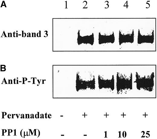 Fig. 3. Detection of Y-phosphorylated band 3 in anti-Lyn immunoprecipitates. / Anti-Lyn immune complexes, obtained as described in Figure 2B, were submitted to SDS-PAGE, transferred to nitrocellulose membranes, and immunostained with either anti-band 3 antibody (A) or anti-P-Y antibody (B). The figure is representative of 3 separate experiments.