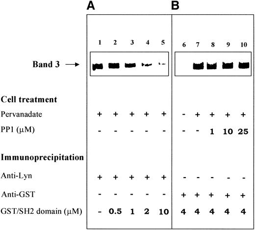 Fig. 7. Recombinant GST-SH2 domain counteracts the interaction between Lyn and phosphorylated band 3. / (A) Immunostaining of band 3 coimmunoprecipitated in anti-Lyn IP. Erythrocytes were treated with pervanadate, and the proteins extracted from the cell membranes were immunoprecipitated with anti-Lyn antibody as described in “Materials and methods.” The immunoprecipitations shown in lanes 2 to 5 were performed in the presence of increasing concentrations of recombinant GST/SH2 domain. (B) Immunostaining of band 3 coimmunoprecipitated in anti-GST IP. Human erythrocytes were treated as in Figure 2B, and the proteins extracted from the cell membranes were immunoprecipitated with anti-GST antibody in the presence of 4-μmol/L recombinant GST-SH2 domain. Immune complexes were submitted to SDS-PAGE, transferred to nitrocellulose membranes, and immunostained with anti-band 3 antibody. Experimental conditions are detailed in “Materials and methods.” The figure is representative of 5 separate experiments.