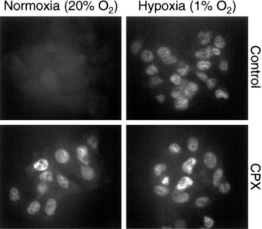 Fig. 5. Immunofluorescence analysis of HIF-1α expression in HepG2 cells. / HepG2 cells were treated with hypoxia (1% oxygen) and/or CPX (8 μmol/L) for 4 hours, and HIF-1α was detected using the monoclonal antibody mgc314 followed by a fluorescein isothiocyanate–conjugated secondary antibody.