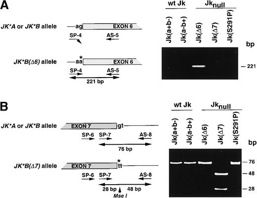 Fig. 1. Identification of JK gene mutations in Jknull variants. / (A) Left, schematic representation of the Jk(Δ6) DNA genotyping assay by allele-specific PCR using primers SP-4 and AS-5. The invariant G nucleotide at the acceptor splice-site of intron 5 in JK*Aor JK*B alleles is replaced by an A in the Jk(Δ6)null allele. Right, the 221-bp PCR product was amplified from the Jk(Δ6) mutant but not from the wt Jk, Jk(a+b−) or Jk(a−b+), Jk(Δ7), and Jk(S291P) samples demonstrating the specificity of the assay. (B) Left, schematic representation of the Jk(Δ7) DNA genotyping assay by PCR-RFLP using primers SP-6, SP-7, and AS-8. The invariant G nucleotide at the donor splice-site of intron 7 inJK*A or JK*B alleles is replaced by a T in theJk(Δ7) null allele, which creates a Mse I restriction site. Right, the 76-bp PCR product encompassing the splice-site mutation was cleaved by Mse I into 48- and 28-bp fragments in the Jk(Δ7) mutant. As expected the PCR products from wt Jk, Jk(a+b−) or Jk(a−b+), Jk(Δ6), and Jk(S291P) samples were uncut. Single base substitution and intronic sequence are shown by a star and in lower case, respectively. Size of fragments (bp) are given on the right.