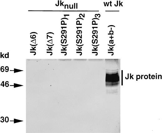 Fig. 6. Immunoblot analysis of Kidd/urea transporter protein from erythrocyte membranes of individuals with common and rare Jk phenotypes. / The RBC membrane proteins (40 μg) were separated by SDS-PAGE and immunoblotted with an affinity-purified rabbit antibody against theN-terminus of the Kidd/urea transporter protein, as described in Materials and methods. Size of products (kd) on the left.