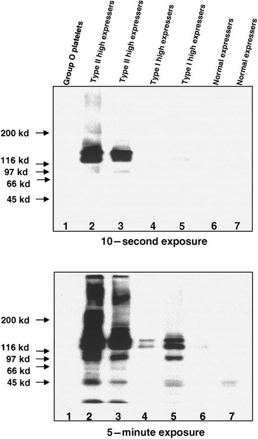 Fig. 8. Western blots of the A antigen on GPs in lysates prepared from group O platelets, normal expressers of A1, and Type I and Type II high expressers of A1. / The platelets were solubilized and separated on a 4%-12% gradient SDS-PAGE under nonreducing conditions. The blots were incubated with monoclonal anti-A (BRIC 145), and the bound antibody was detected with HRP-labeled antimouse IgG and chemiluminescence after 10 seconds (top) and 5 minutes (bottom). (Lane 1) Group O platelets. (Lanes 2 and 3) Type II high-expresser platelets with heavily stained bands of approximately 140 kd and 130 kd at 10-second exposure. (Lanes 4 and 5) Type I high-expresser platelets showing bands with similar mobilities at 5-minute exposure. (Lanes 6 and 7) Normal-expresser A1platelets.