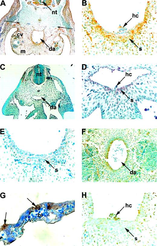 Fig. 1. Expression of transforming growth factors BMP-4 and TGFβ1 in the human embryonic AGM region. / Immunohistochemical analysis on transverse sections of human embryos and yolk sac. (A) Within the AGM region at 34 days, a gradient of BMP-4 protein exists across the dorsoventral axis at the level of the AGM region. BMP-4 is expressed in the ventral mesoderm (below thin arrows), which includes the dorsal aorta (da), cardinal veins (cv), and mesonephros (m), whereas the dorsal mesoderm (above thin arrows), between the dorsal aorta and neural tube (nt), is predominantly negative. (B) Higher magnification of (A) in the region of the dorsal aorta. BMP-4 expression is polarized to the ventral stromal region (s) underlying the intra-aortic hematopoietic cluster (hc). (C) In contrast, in a younger 28-day-old embryo, BMP-4 is expressed at low level in both ventral and dorsal mesoderm, with few highly positive cells. (D) However, as shown by a higher magnification of (C), BMP-4 expression is at this stage restricted to the thin “stromal” layer (s) underlying the ventral wall of the aorta from which a cluster of cells (hc) can be seen emerging. (E) At more caudal levels (34 days), no intra-aortic clusters are visible and BMP-4 expression is markedly lower than in the AGM, consistent with an anterior-posterior progression of development during embryogenesis. (F) At 38 days gestation, BMP-4 expression within the AGM region is relatively uniform around the entire aorta and is not polarized to the ventral wall. (G) Cells expressing BMP-4 (arrows) are specifically associated with blood islands (bi) in the embryonic yolk sac (31 days). (H) TGFβ1 is expressed by cells within the intra-aortic cluster (hc). Uniformly low level expression is detected around the aorta. (Original magnification: A, C, ×15; B, D, E, G, H ×78, F ×36).