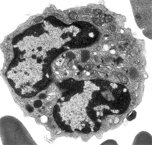 Electron micrograph shows a mature mouse basophil that was present in the FcεR+ cells sorted from normal mouse bone marrow. / (For more details, see Seder et al3and Dvorak et al.4) The mature nucleus has heavily condensed chromatin in 2 lobes. Small numbers of mature electron-dense granules are evident in the cytoplasm. Numerous mitochondria and electron-lucent secretory vesicles constitute the other cytoplasmic organelles in this view. Original magnification, × 23 000.