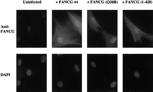 Fig. 7. A truncated mutant form of the FANCG protein translocates to the cell nucleus but fails to function. / The primary FA-G fibroblast line, DF3, was transduced with retroviral constructs encoding the indicated wild-type or mutant forms of the FANCG protein. Following retroviral transduction, the cells were analyzed by immunofluorescence with anti-FANCG antisera or by staining with the DNA-specific dye, DAPI (4,6-diamidino-2-phenylindole). In parallel, the cells were analyzed for correction of MMC sensitivity (data not shown). The wild-type FANCG and FANCG(Q26R) protein corrected the MMC sensitivity of the DF3 cells, but the FANCG 1-428 mutant failed to complement the cells.