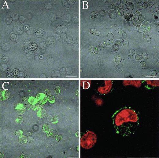 Fig. 1. Induction of Mcl-1 protein by PMA in U937 cells. / U937 cells were prepared for immunofluorescence confocal microscopy to show Mcl-1 expression. (A) Second-antibody only labeled PMA-treated U937 cells after 18 hours of treatment. (B) Undifferentiated U937 cells. (C) PMA-treated U937 cells after 18 hours of treatment. (D) The same as panel C, with additional PI counterstaining of nuclei. Bar = 15 μm.