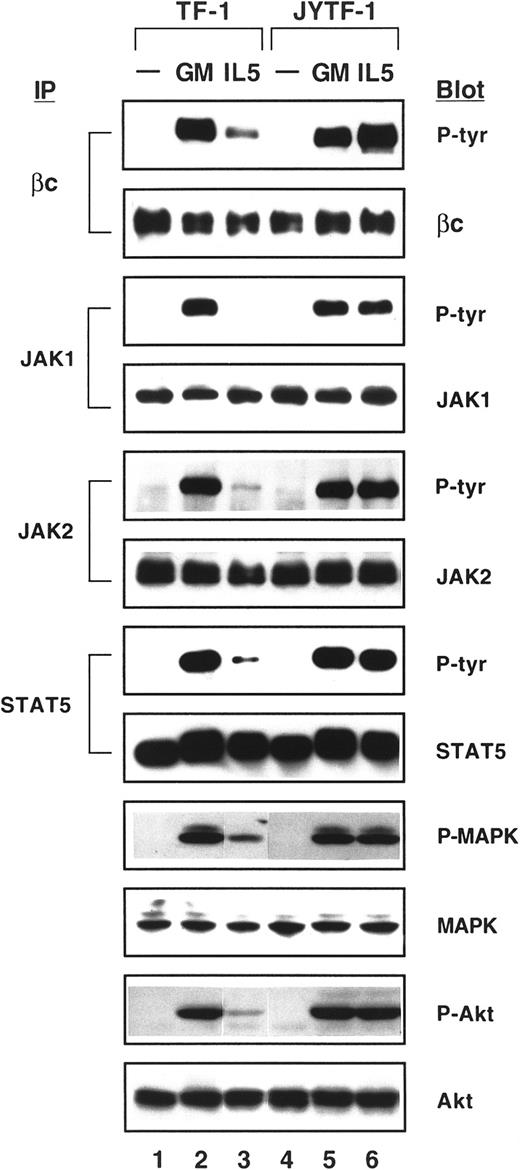 Fig. 3. Differential phosphorylation of signaling components by hIL-5 in TF-1 and JYTF-1 cells. / Both TF-1 and JYTF-1 cells were cytokine-depleted for 24 hours (lanes 1 and 4) before stimulation with GM-CSF (lanes 2 and 5) and IL-5 (lanes 3 and 6) (as indicated above the picture) for 5 minutes. Cell lysates were prepared and subjected to immunoprecipitation (IP)-Western (Blot) (for βc, JAK1, JAK2, and STAT5) or direct Western (for MAPK and Akt) blot analysis. For IP-Blot analysis, cell lysates were immunoprecipitated, fractionated, and transferred by Western blotting and the membrane was probed with antiphosphotyrosine antibody (indicated as P-tyr on the right-hand side, under Blot). This membrane was stripped as described in Materials and methods and then reprobed with anti-βc, -JAK1, -JAK2, or -STAT5 antibody (as indicated on the right-hand side, under Blot). For direct Western blot analysis, 150 μg of whole cell lysates was fractionated directly in a 10% SDS-PAGE and the Western blot was then probed with antibodies against phospho-MAPK (MAPK = ERK1p44 + ERK2p42) and phospho-Akt. These 2 blots were then reprobed with anti-MAPK and anti-Akt antibodies. The Western blot signals were visualized by ECL reaction and exposed onto x-ray film.