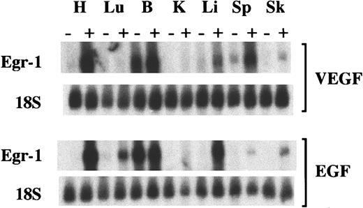 Fig. 3. Induction of Egr-1 mRNA after intraperitoneal injections of VEGF and EGF. / Mice received intraperitoneal injections of VEGF, EGF, or normal saline. Tissues were processed 1 hour later for Northern blot analysis of Egr-1 and 18S ribosome in the heart (H), lung (Lu), brain (B), kidney (K), liver (Li), spleen (Sp), and skeletal muscle (Sk). +, growth factor-treated mice; −, normal saline-treated mice.