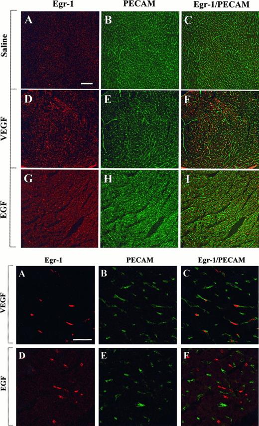 Fig. 4. Confocal microscopy and double immunostaining of Egr-1 and PECAM in the heart of VEGF- and EGF-treated mice. / Mice received intraperitoneal injections of normal saline, VEGF, or EGF. Hearts were removed 1 hour later. Tissue sections were double immunostained with a rabbit polyclonal anti-Egr-1 antibody and a rat monoclonal anti-CD31 antibody, washed in PBS, and incubated with Cy3-conjugated goat antirabbit IgG and FITC-conjugated goat antirat IgG. (Top) Low-power view of optical sections through the myocardium of a normal saline-treated animal (A-C), a VEGF-treated animal (D-F), and an EGF-treated animal (G-I). Egr-1 immunofluorescence is shown on the left (A, D, G), and PECAM immunofluorescence is shown in the middle (B, E, H). The 2 images are combined on the right (C, F, I). Bar, 100 μm. (Bottom) High-power view of optical sections through the myocardium of VEGF-treated animal (A-C) and EGF-treated animal (D-F). Egr-1 immunofluorescence is shown on the left (A, D), and PECAM immunofluorescence is shown in the middle (B, E). The 2 images are combined on the right (C, F). Bar, 25 μm.