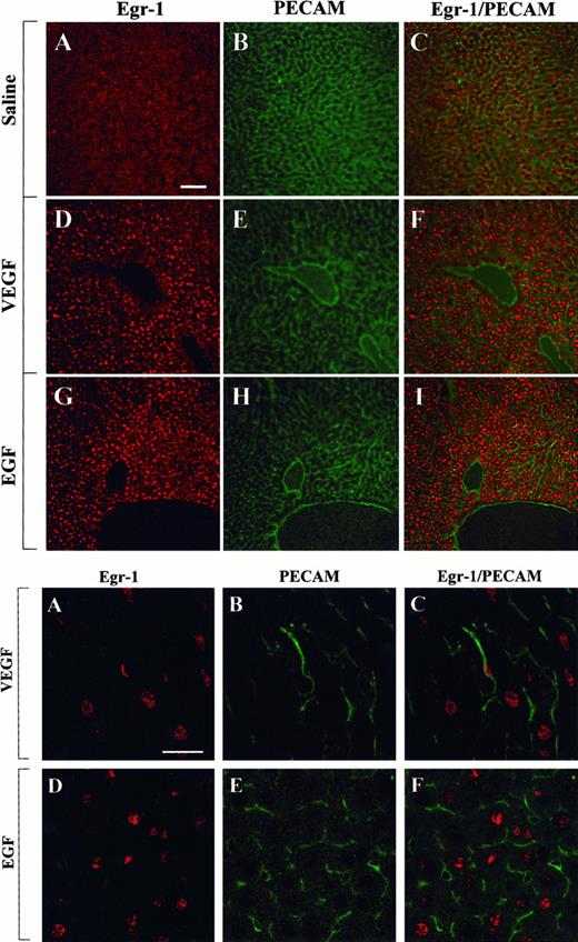 Fig. 5. Confocal microscopy and double immunostaining of Egr-1 and PECAM in the liver of VEGF- and EGF-treated mice. / Mice received intraperitoneal injections of normal saline, VEGF, or EGF. Livers were removed 1 hour later and processed for immunodetection of Egr-1 and PECAM, as described in Figure 4. (Top) Low-power view of optical sections through the liver of normal saline-treated animal (A-C), VEGF-treated animal (D-F), and EGF-treated animal (G-I). Egr-1 immunofluorescence is shown on the left (A, D, G), and PECAM immunofluorescence is shown in the middle (B, E, H). The 2 images are combined on the right (C, F, I). Bar, 100 μm. (Bottom) High-power view of optical sections through the liver of VEGF-treated animal (A-C) and EGF-treated animal (D-F). Egr-1 immunofluorescence is shown on the left (A, D), and PECAM immunofluorescence is shown in the middle (B, E). The 2 images are combined on the right (C, F). Bar, 25 μm.