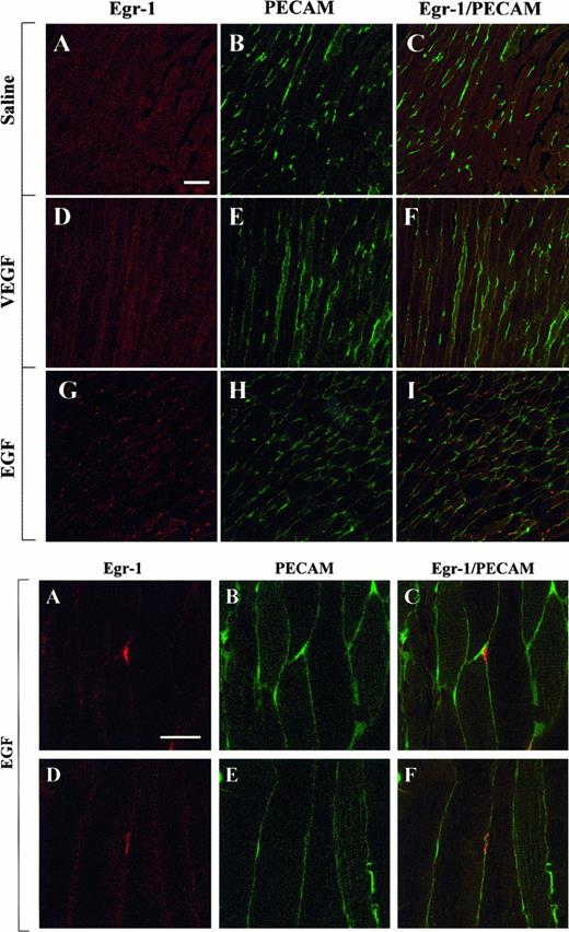 Fig. 6. Confocal microscopy and double immunostaining of Egr-1 and PECAM in the skeletal muscle of VEGF- and EGF-treated mice. / Mice received intraperitoneal injections of normal saline, VEGF, or EGF. The thigh muscle was removed 1 hour later and processed for immunodetection of Egr-1 and PECAM, as described in Figure 4. (Top) Low-power view of optical sections through the skeletal muscle of normal saline-treated animal (A-C), VEGF-treated animal (D-F), and EGF-treated animal (G-I). Egr-1 immunofluorescence is shown on the left (A, D, G), and PECAM immunofluorescence is shown in the middle (B, E, H). The 2 images are combined on the right (C, F, I). Bar, 100 μm. (Bottom) High-power view of optical sections through the skeletal muscle of EGF-treated animals. Egr-1 immunofluorescence is shown on the left (A, D), and PECAM immunofluorescence is shown in the middle (B, E). The 2 images are combined on the right (C, F). Bar, 25 μm.
