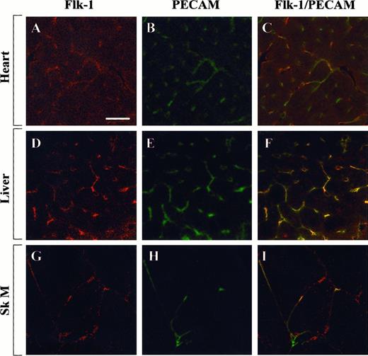 Fig. 7. Confocal microscopy and double immunostaining of Flk-1 and PECAM in mouse tissues. / Tissue sections from control mice were processed for immunodetection of Flk-1 and PECAM. High-power view of optical sections through the heart (A-C), liver (D-F), and skeletal muscle (G-I). Flk-1 immunofluorescence is shown on the left (A, D, G), and PECAM immunofluorescence is shown in the middle (B, E, H). The 2 images are combined on the right (C, F, I). Bar, 100 μm.