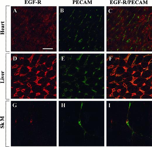 Fig. 8. Confocal microscopy and double immunostaining of EGF-R and PECAM in mouse tissues. / Tissue sections from control mice were processed for immunodetection of EGF-R and PECAM. High-power view of optical sections through the heart (A-C), liver (D-F), and skeletal muscle (G-I). EGF-R immunofluorescence is shown on the left (A, D, G), and PECAM immunofluorescence is shown in the middle (B, E, H). The 2 images are combined on the right (C, F, I). Bar, 100 μm.