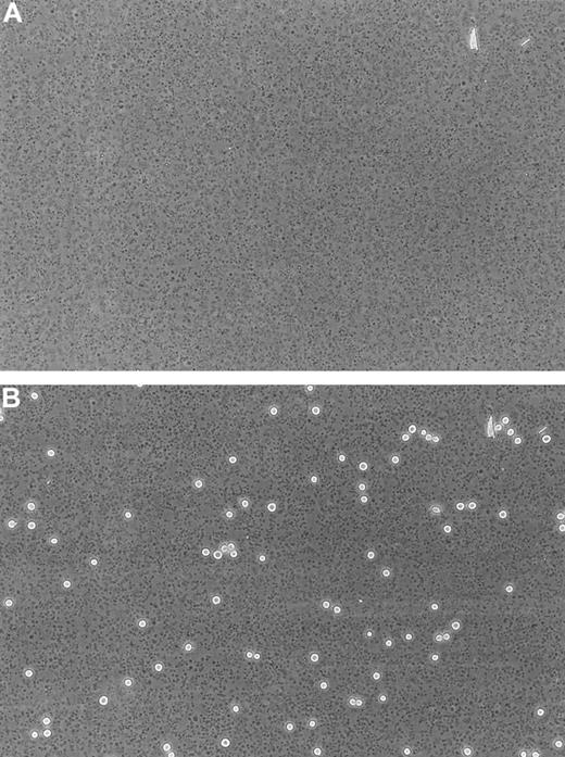 Fig. 1. Immobilized human platelets. / Phase-contrast photomicrographs (× 20) of a confluent layer of immobilized human platelets (17 580 ± 971/mm2, n = 5) bound to an APES-treated glass slide before (A) and after (B) the perfusion of LS174T cells for 10 minutes at a shear stress level of 0.8 dyn/cm2.