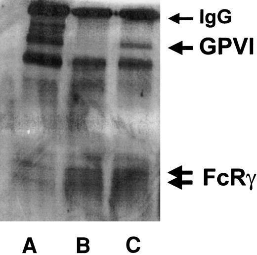 Fig. 7. Coexpression of rhusGPVI with FcR-γ chain. / Lysates from (A) platelets, (B) control, or (C) GPVI-transduced U937 cells were incubated with a polyclonal anti–FcR-γ antibody and protein A–sepharose. Immunoprecipitated proteins were separated by SDS-PAGE and blotted on a PVDF membrane. The membrane was incubated with a mixture of anti–FcR-γ and anti-GPVI antibodies revealed with peroxydase-coupled protein A and chemiluminescence.