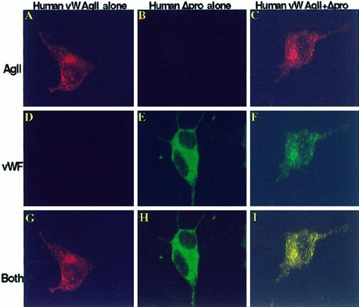 Fig. 4. The propeptide, vW AgII, trafficks vWF to granular storage in AtT-20 cells. / vW AgII functions as an intracellular chaperone. AtT-20 cells were transiently transfected with human propeptide alone, vW-AgII, human mature vWF alone, or Hu-Δpro or were cotransfected with Hu-vW-AgII + Hu-Δpro. After 72 hours, cells were fixed, permeabilized, dual stained with a mix of monoclonal antibodies to vW AgII and a polyclonal antibody to vWF, and detected with Texas Red-conjugated donkey antimouse IgG and FITC-conjugated donkey antirabbit IgG by confocal microscopy. (A-C) Cells stained for vW AgII. (D-F) vWF staining. The merges of vW AgII stain and vWF stain are shown in G to I. Colocalization of vW AgII and vWF is shown in yellow. Expression of vW AgII alone resulted in granular storage of vW AgII, as shown in A, indicating that vW AgII contains the epitope or conformation necessary for sorting to regulated storage; no vWF was detected (D). Expression of mature vWF alone (B, E, H) showed only a cytoplasmic staining pattern of vWF; no granular storage was observed. Expression of vW AgII in trans with mature vWF resulted in granular storage of both vW AgII and vWF (C, F, I). Furthermore, the 2 proteins were colocalized in storage granules, as shown in I. This suggests that vW AgII contains the necessary signal(s) for sorting to storage, and only through interaction with vW AgII is vWF sorted to storage. Total magnification, 1410×.
