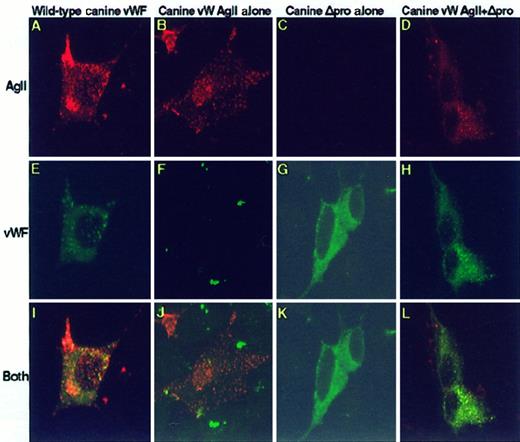 Fig. 5. Intracellular distribution of canine vW AgII and vWF. / Canine constructs were transiently expressed in AtT-20 cells. Cells were fixed, permeabilized, dual stained with monoclonal antibodies to vW AgII and a polyclonal antibody to vWF that cross-react with canine and are detected with Texas Red-conjugated donkey antimouse IgG and FITC-conjugated donkey antirabbit IgG by confocal microscopy. (A-D) Cells stained for vW AgII. (E-H) vWF staining. Merges of vW AgII stain and vWF stain are shown in I to L; colocalization of vW AgII and vWF is shown in yellow. Cells expressing full-length canine vWF (A, E, I) exhibited granular storage of both vW AgII and vWF, which were colocalized as shown in I. Cells expressing canine vW AgII alone (B, F, J) displayed granular storage of vW AgII, whereas no vWF was detected. Expression of canine mature vWF resulted in a cytoplasmic staining pattern of canine vWF; no granular storage was observed (C, G, K). Co-expression of canine vW AgII and canine mature vWF (D, H, L) resulted in colocalized granular storage of both vW AgII and vWF. These results demonstrate that vW AgII chaperones vWF to regulated storage in dogs as in humans. Total magnification, 1410×.