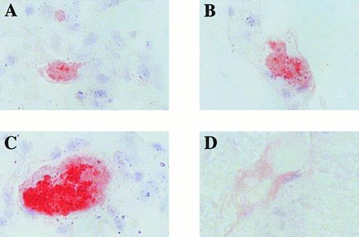 Fig. 3. Immunohistochemical analysis of pulmonary microemboli. / WT mice were injected with the standard preparation of unlabeled microparticles. The lungs were harvested 10 minutes later, washed, fixed, and incubated with (A-C) a murine antihuman fibrin-specific antibody or (D) a nonimmune IgG1 control and enzyme-conjugated secondary antibody (original magnifications × 200).