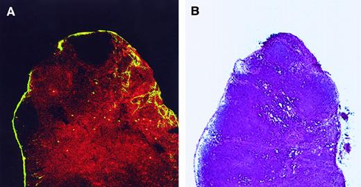 Fig. 5. CD8+ LC are localized in the T-cell area of LN. / (A) Twenty-four hours after skin painting with FITC, draining LN were harvested, sectioned, fixed in acetone, and stained with biotin-labeled anti-CD8 antibody and then by streptavidin–PE to determine the localization of the CD8+ LC. Tissue was analyzed by confocal microscopy. Red cells represent CD8+ T cells. Most FITC+ cells (yellow) coexpress CD8 and are present in the T-cell region. Magnification, 10×. Adjacent cryostat sections (5 μm) stained with anti-CD4 revealed the CD4+ T cells to be localized in the same regions as the CD8+ cells (data not shown). (B) Adjacent tissue sections were fixed in methanol, air dried, and stained with hematoxylin and eosin to orient the reader to the normal architecture of the LN. Stained sections were analyzed using a bright-field microscope. Magnification, 10×.