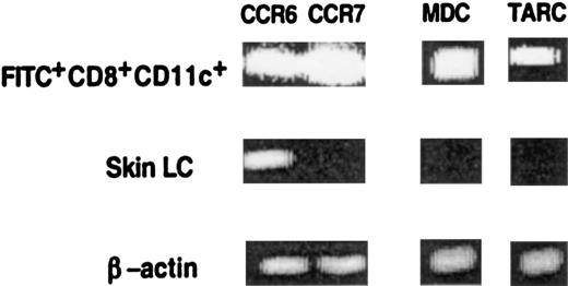 Fig. 6. CD8+ LC in LN, but not in skin, express the chemokine receptor CCR7 and the T-cell attracting chemokines MDC and TARC. / LC were isolated from ear skin as described in “Materials and methods,” and FITC+CD8+CD11c+cells were isolated from the LN of painted mice. The presence of CCR6, CCR7, MDC, and TARC mRNA was assayed by RT-PCR using specific primers. For each sample cDNA synthesis was controlled by RT-PCR using β-actin primers for 30 cycles. Results of 1 of 3 representative experiments are shown.