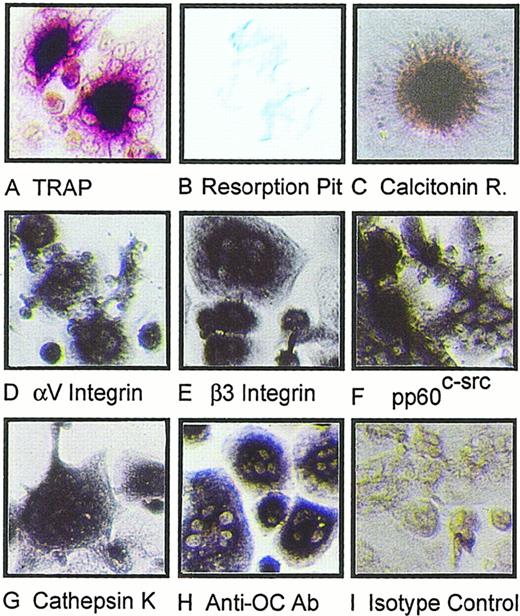 Fig. 3. Characterization of human osteoclasts generated by IL-7 stimulation of PBSCs. / The multinuclear cells formed after IL-7 stimulation were analyzed for markers of authentic human OCs (see “Materials and methods”). These cells were found to express tartrate resistant acid phosphatase (TRAP) (A); resorp pits on dentine slices (B); express calcitonin receptors (C), which were competed out by 200-fold excess unlabeled calcitonin (data not shown); express the integrin subunits αV (D) and β3 (E); express pp60c-src (F), mature cathepsin K (G), and react with the anti-OC antibody 121F (H). Nonspecific binding was assessed by IgG isotype control (I). Magnification = 200 × for all panels.