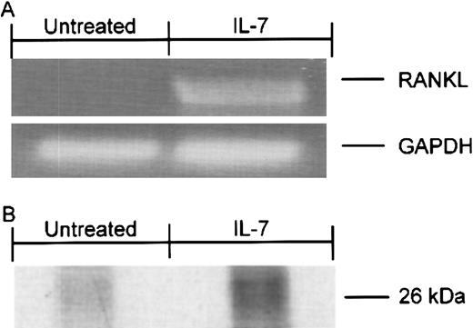Fig. 5. IL-7 up-regulates RANKL mRNA and RANKL secretion in T cells. / (A) Negatively isolated T cells from PBSCs were stimulated with IL-7 for 24 hours and RNA isolated. Semiquantitative RT-PCR was conducted as described in the “Materials and methods” section. IL-7–stimulated T cells showed up-regulation of RANKL expression. No RANK message was detectable in unstimulated T cells. (B) Secretion of RANKL into the culture supernatant was measured by metabolic labeling of purified T cells, followed by RANKL immunoprecipitation and SDS-PAGE (see “Materials and methods”). Soluble RANKL was detected in IL-7–stimulated cells but not in unstimulated cells. Data are representative of 2 independent experiments.