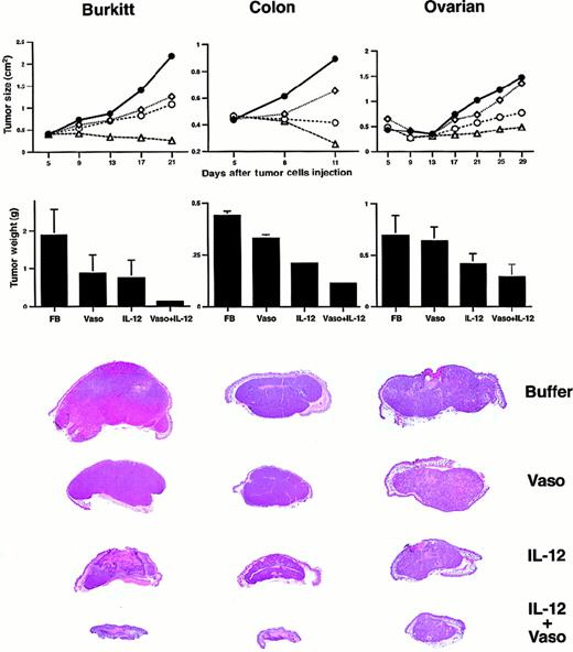 Fig. 1. Treatment of malignant tumors with vasostatin, IL-12, and vasostatin plus IL-12. / All treatments were given by means of daily (6 days per week) sc injections of either buffer alone, vasostatin (100 μg per mouse), murine IL-12 (100 ng per mouse), or vasostatin (100 μg per mouse) plus murine IL-12 (100 ng per mouse) at a site proximal to the tumor. Tumor size was estimated as the product of 2-dimensional caliper measurements. Mean tumor size is shown for each time point. Mice were killed and autopsied; tumors were removed in toto, weighed, and formalin fixed. Mean tumor weight and standard deviations are shown for each group. Gross morphology of representative tumors (hematoxylin and eosin stain) from each group is shown. CA46 Burkitt lymphoma cell line was inoculated subcutaneously into athymic mice (8 × 106cells per mouse), and 5 days later, tumor treatment was initiated; there were 18 mice in the group treated with vasostatin plus IL-12; 11 mice in each of the other groups. SW620 colon carcinoma cell line was inoculated subcutaneously into athymic mice (107 cells per mouse); treatment with buffer alone and vasostatin alone was started 1 day after cell injection, and IL-12 was started 1 day later. There were 11 mice in each group. OVCAR ovarian carcinoma cell line was inoculated subcutaneously into athymic mice (8 × 106 cells per mouse); all treatment was started 8 hours after cell injection. There were 9 mice in the buffer-treated group, and 10 mice in each of the other groups. Buffer (●—●); vasostatin (⋄—⋄); murine IL-12 (○—○); vasostatin plus murine IL-12 (▵—▵).