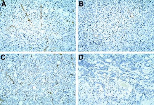Fig. 4. Vascular structures in Burkitt tumors treated with vasostatin, murine IL-12, or vasostatin plus murine IL-12 detected by immunohistochemical staining of murine CD31. / Counterstained with hematoxylin, original magnification ×20. Tumor tissue from animals treated with (A) buffer alone; (B) vasostatin alone; (C) murine IL-12 alone; and (D) vasostatin plus murine IL-12.
