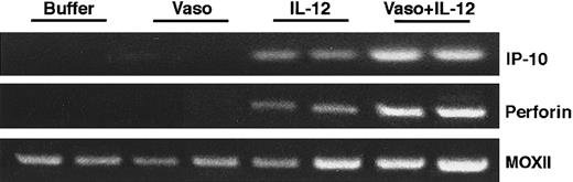 Fig. 5. Murine IP-10 and perforin expression in Burkitt tumors treated with vasostatin, murine IL-12, or vasostatin plus murine IL-12. / Semiquantitative RT-PCR analysis of total cellular RNA using appropriately designed primers.