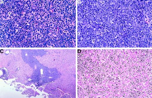 Fig. 6. Histologic features of tumors arising in transgenic mice. / Tissue sections were stained with hematoxylin and eosin for thymic tumors from E2A-PBX1 single (A) orNotch1ΔC/E2A-PBX1 compound (B) transgenic mice and liver infiltrated by lymphoma (C and D). Magnifications: A, B, and D, 200 ×; C, 40 ×.