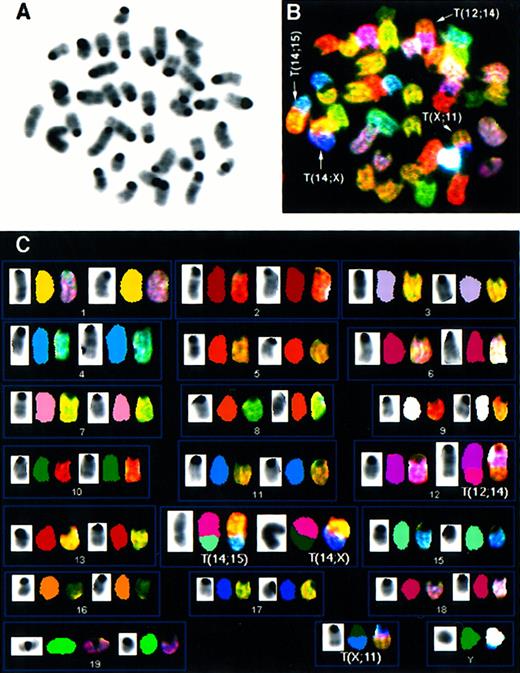 Fig. 1. Spectral karyotyping analysis of thymic lymphoma AT-4 reveals multiple chromosomal aberrations. / SKY analysis of a representative metaphase from thymic lymphoma AT-4. The inverted DAPI-stained image is shown in (A), and the RGB display image in (B), with arrows indicating the chromosomal aberrations. The full karyotype is shown in (C), with each chromosome in its spectra-based classification color flanked by the DAPI and RGB images (for details see “Materials and methods”). The karyotype of tumor AT-4 is 39, XY, T(12;14), T(14;15); T(14;X), T(X;11).
