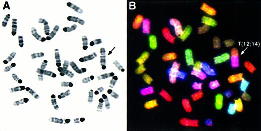 Fig. 3. SKY analysis of. / Atm−/−spleen cells reveals chromosome 14 rearrangements. Inverted DAPI-stained (A) and RGB display images (B) of a representative metaphase from anAtm−/− mouse splenic T cell. The karyotype is 40, XX, T(12;14). Band analysis indicates that the breakpoint of the translocation is in band 14D. There are 2 normal copies of chromosome 14, so the 14 material in the T(12;14) is a duplication of bands D-E.