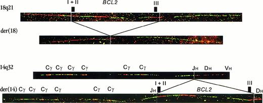 Fig. 1. Fiber FISH with bar codes of probes for the. / BCL2 gene and IGH locus.The top fiber shows a hybridization pattern representing a germlineBCL2 allele. The second fiber is a rearrangement pattern, as observed in case FL4104. It represents the derivative chromosome 18 from which the BCL2 gene was deleted. The third fiber is the hybridization pattern of a germline IGH allele. The position of Cγ genes and JH, DH, and VH regions is indicated.2 The last fiber shows an insertion of theBCL2 gene into the IGH locus. The CHgene region is juxtaposed to the 5′-side of the BCL2 gene. At the 3′-side, part of cosmid U2-2, containing most of the DH region, is present (labeled in red). Because in this image the most 3′-BCL2 cosmid is also in red, the breakpoint junction is not visible. Hybridization of these probes in different colors confirmed the juxtaposition of cosmid U2-2 to the BCL2 gene (not shown).
