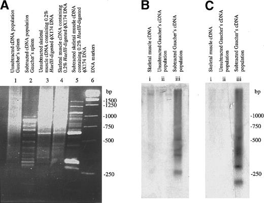 Fig. 1. Enrichment of genes differentially expressed in Gaucher tissue. / (A) Suppression subtraction hybridization. The figure shows ethidium bromide–stained cDNA fragments resolved by electrophoresis in a 2% wt/vol agarose gel. (B) Southern blot analysis of subtracted (enriched) and unsubtracted Gaucher spleen cDNA library hybridized with32P-labeled human tartrate-resistant Acp 5 cDNA. The principal hybridization species correspond to the predictedRsaI fragments of 423 and 590 bp.23 (C) Southern blot of subtracted (enriched) and unsubtracted Gaucher spleen cDNA library hybridized with 32P-labeled human chitotriosidase cDNA. The principal hybridizing species correspond to the predicted RsaI fragments of 123, 423, and 488 bp.21