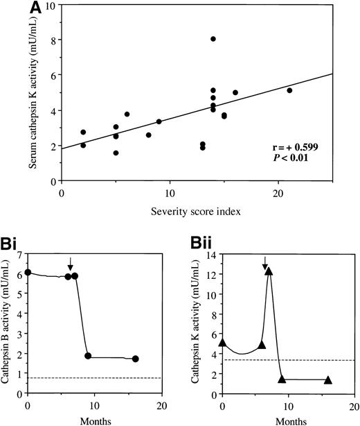 Fig. 7. Cathepsin activities and disease manifestations. / (A) The relation between clinical severity score index calculated according to Zimran et al41 and serum cathepsin K activity in 20 patients with untreated type I Gaucher disease; similar data were obtained for measurements of cathepsins B and S (see text). (B) Serial measurements of cathepsins B (i) and K (ii) in a 52-year-old man with osteoporosis due to Gaucher disease (N370S/84GG genotype), who was previously treated by splenectomy. The horizontal axis shows the time after starting 30 IU/kg/mo imiglucerase. At 6 months the patient experienced an episode of avascular necrosis of the femoral head, shown by the arrow. Cathepsin activities were determined retrospectively in stored sera routinely collected at clinical evaluations. The dotted lines represent the 95% upper confidence limits of serum cathepsin activities in 26 healthy control subjects.