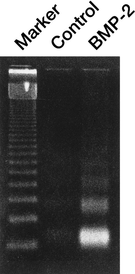 Fig. 3. BMP-2–induced apoptosis of U266 cells. / Agarose gel electrophoresis of DNA extracted from U266 cells treated with 50 ng/mL BMP-2 for 48 hours. A 123–base pair DNA ladder was used as a molecular marker. DNA was detected as ultraviolet fluorescence after ethidium bromide staining.