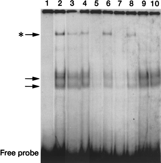 Fig. 8. Down-regulation of in vitro DNA-binding activity of STAT3 by BMP-2. / EMSA using untreated U266 nuclear extracts (lane 1) and a radiolabeled STAT3 wild-type probe (GATCCGACATTTCCCGTAAATCG) generated DNA-protein complexes (arrows, lane 2), which were eliminated by a 100-fold molar excess of self-competitor (lane 5), but not by the same molar excess of the mutant STAT3 oligonucleotide that lacks the STAT binding site (lane 6). A similar sequence-specific DNA-binding activity was seen with the use of nuclear extracts from U266 cells treated with BMP-2 for 120 minutes (lanes 7-8). Supershift assays using the radiolabeled STAT3 probe, untreated or BMP-2–treated nuclear extract, and an anti-STAT3 polyclonal antibody eliminated cells that had been treated with a slowly migrating complex (indicated by the asterisk) (lanes 9-10). The uppermost DNA-protein complexes generated by nuclear extract prepared with BMP-2 for either 30 minutes or 120 minutes (lanes 3 and 4, respectively) were lower in intensity compared with those from untreated nuclear extract. The position of the free probe is indicated at the bottom of the gels.