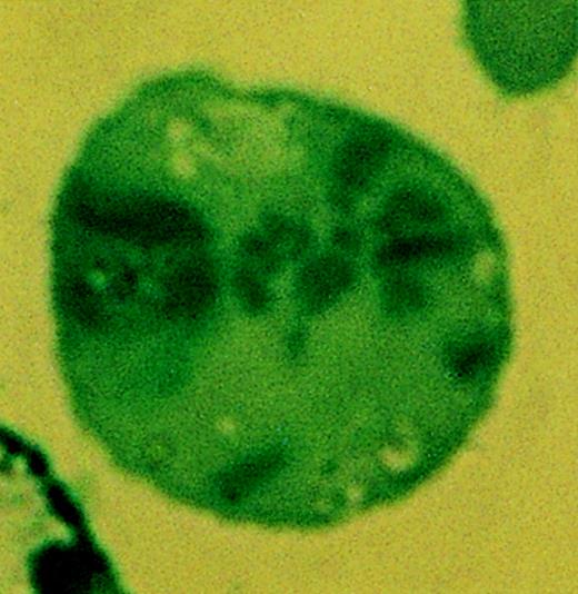 The chromosomes can tell you what they're made of. / Rosalba Rana and Lucia Centurione, Biomorphology Department, Faculty of Medicine, University “G. D'Annunzio,” Chieti, Italy.