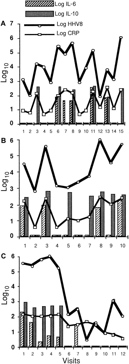 Fig. 4. Longitudinal evaluation of HHV8 DNA copy numbers in PBMCs, serum CRP, plasma IL-6, and plasma IL-10. / Longitudinal evaluation of HHV8 DNA copy numbers in PBMCs, serum CRP, plasma IL-6, and plasma IL-10 in 3 patients shows a strong correlation between these 4 covariates in patient 2 (A) within 15 visits over a 25-month period and in patient 13 (B) within 10 visits over a 24-month period. Panel (C) shows a dramatic decrease in all biological markers during the first 4 weeks following the initiation of chemotherapy in patient 3.